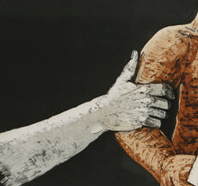 The Missing Arm