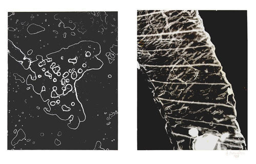 Amoeba and Hair Detail (Microscope) Black and White | H. Millington,{{product.type}}